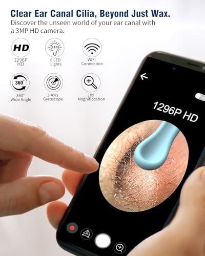 Ear Wax Removal Camera, 1296P HD, 8pcs Ear Set, Wireless WiFi Otoscope, 6 Lights, Rechargeable Earwax Removal Tool Kit (Black) B29906